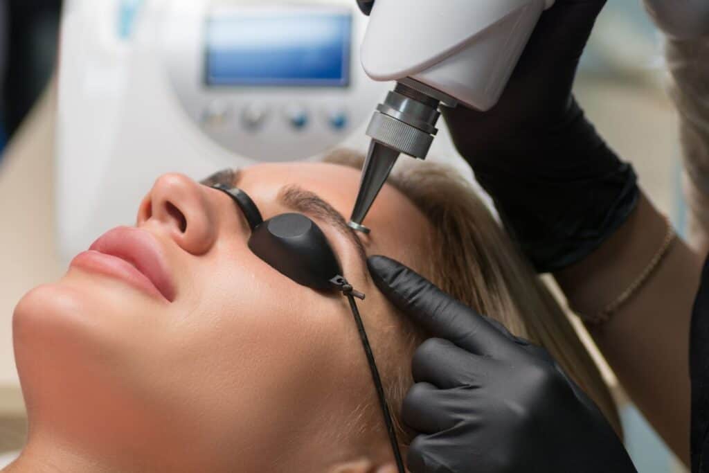 woman getting laser treatment on her eyebrows